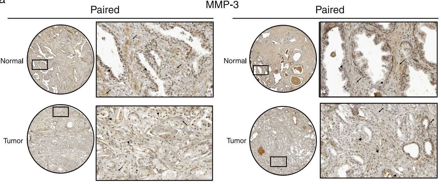 Representative digital images of IHC staining of MMP-3.jpg